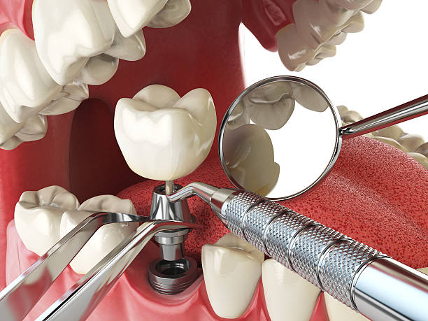 Best Urgent Dental Care in Charleston, SC